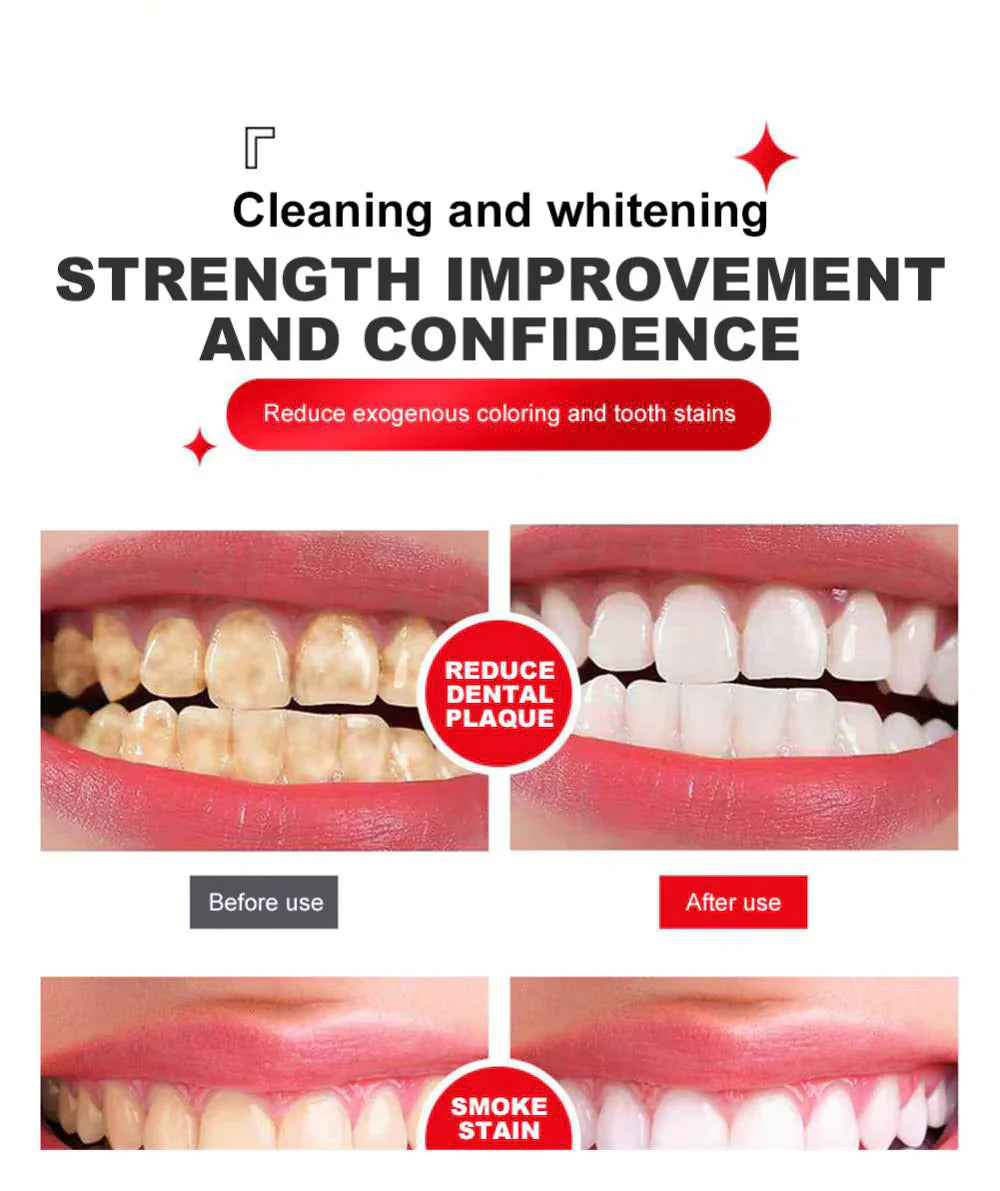 Yayashi SP4 Oral Care Probiotic Whitening Toothpaste 120g